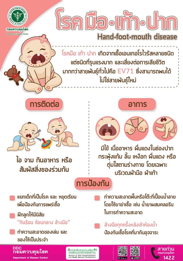 แนะ 4 วิธีรับมือโรคมือ เท้า ปากในเด็ก